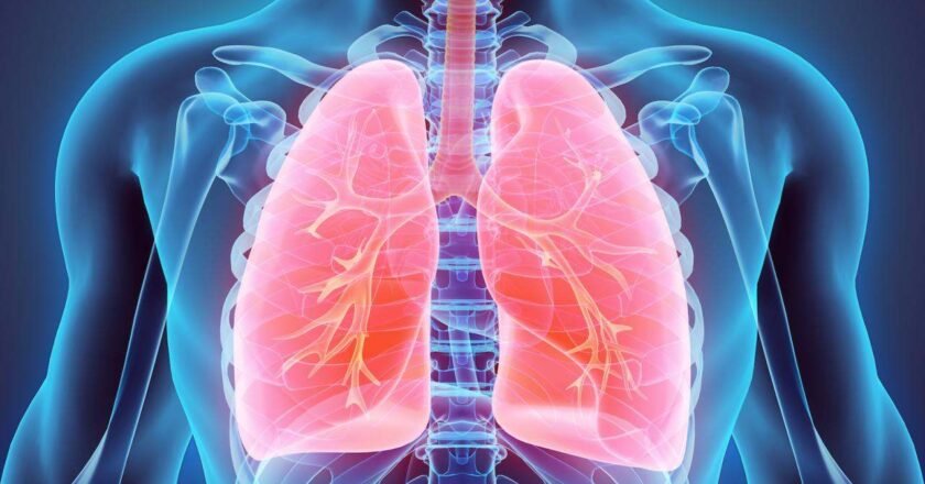Understanding Lung Cancer: Causes, Symptoms, and Treatment Options